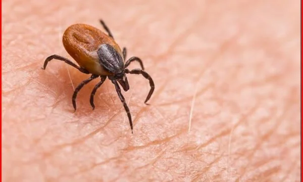 Shenjat që tregojnë se pickimi i një insekti mund të jetë më serioz nga sa duket