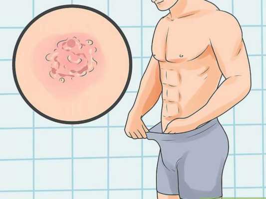 Po rrezikoheni nga herpesi gjenital, ja simptomat që shfaq dhe si ta kuptoni që jeni prekur