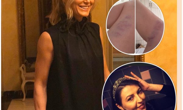 Dëshmitarja e ngjarjes bën horë Anita Haradinajn: E shave dhe përule e pastaj e hodhe mbi tavolinë