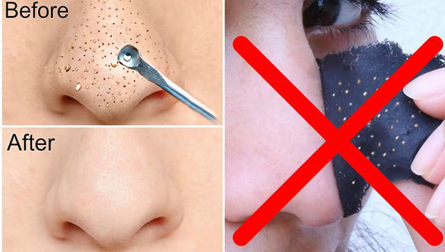 Hapat për një procedurë peeling në shtëpi; Rezultati i njëjtë sikur të shkonit në klinikë