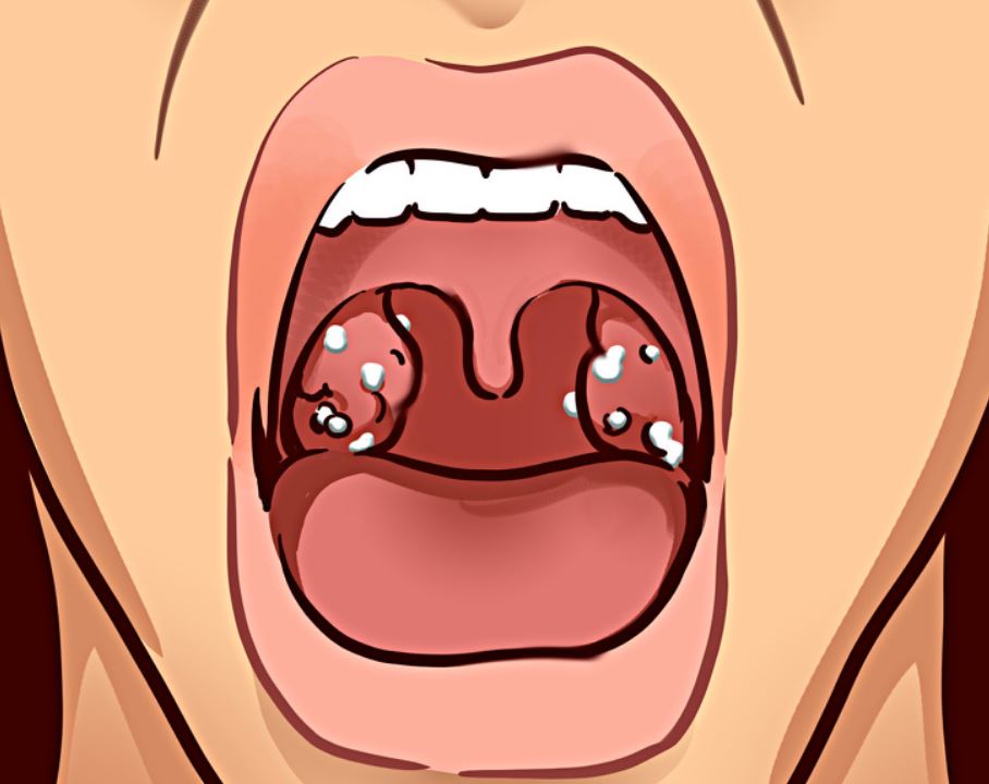 Ndjeni një shije të keqe? Goja juaj po ju paralajmeron për një rrezik