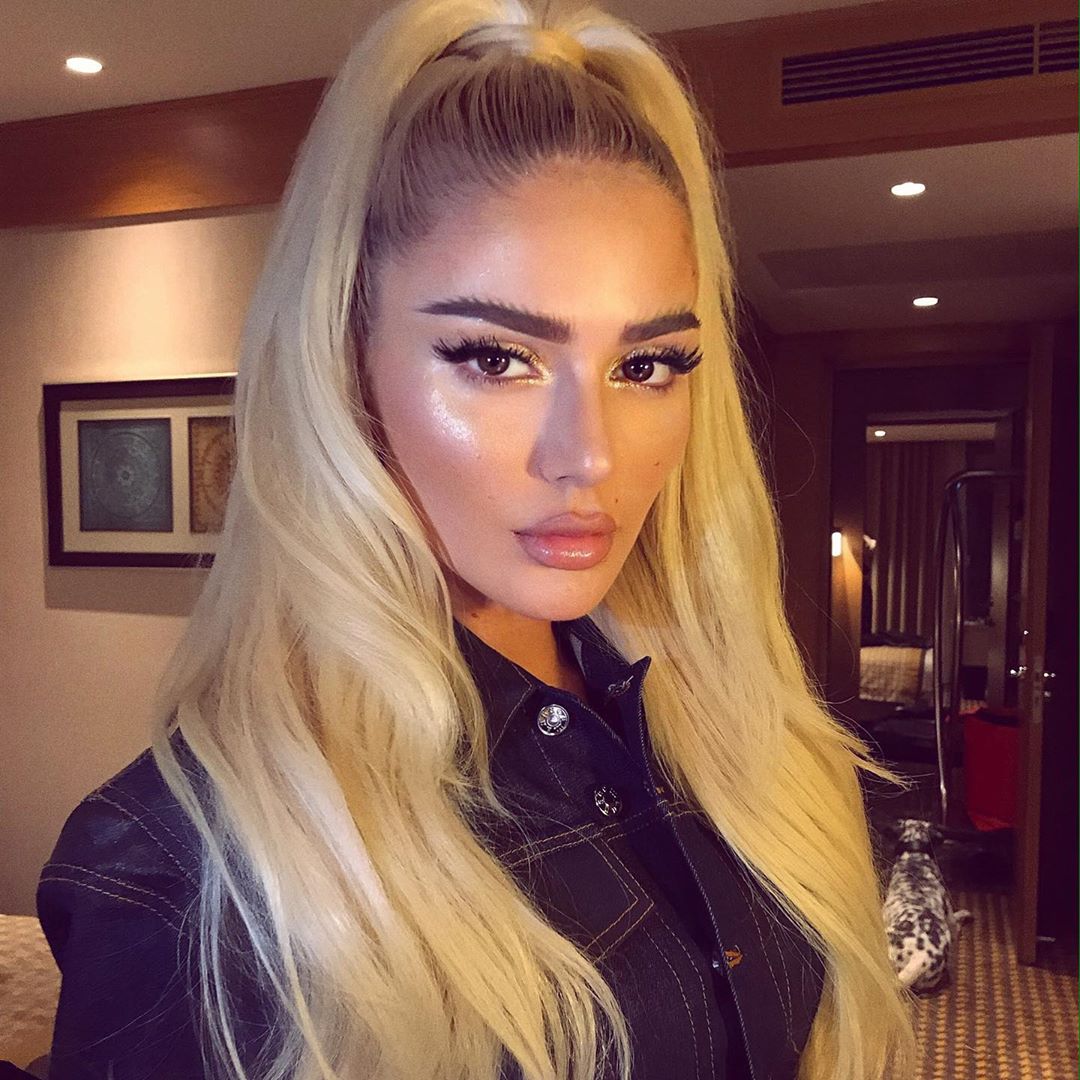 Çfarë i tha Mozzikut? Ky është teksti i plotë në shqip i këngës së Loredanës