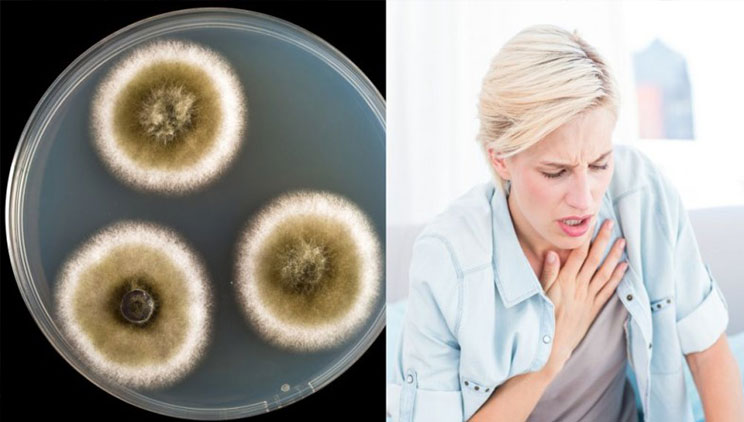 Sëmundja e mykut është kudo, ja shenjat si ta kuptoni që vuani prej këtij problemi