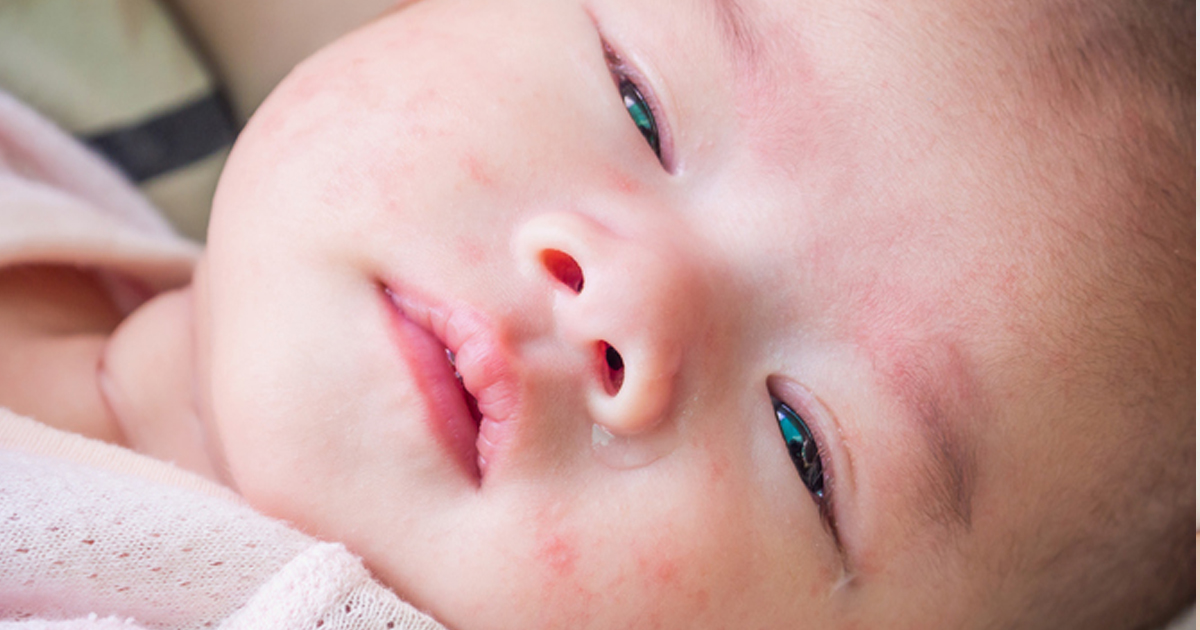 Mrekulli: Bebja 17 ditëshe shërohet nga koronavirusi pa asnjë mjekim
