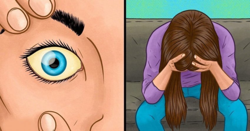 10 shenjat që trupi juaj po vuan nga mungesa e vitaminës B12