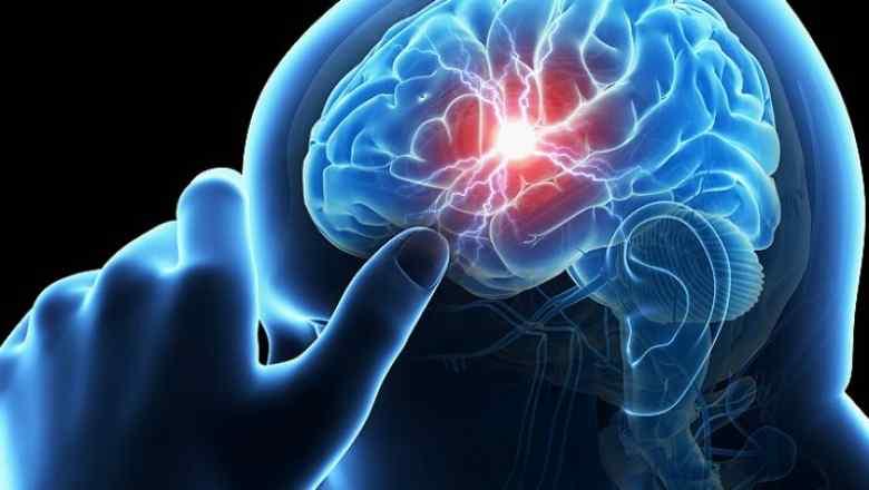 ​Dita Ndërkombëtare e Epilepsisë