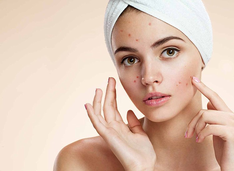 Lëkurës i duhen këto 4 vitamina që të duket e bukur