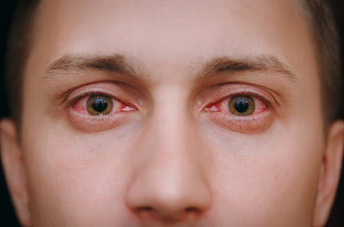 Kontrolloni: Sytë zbulojnë nëse keni koronavirus