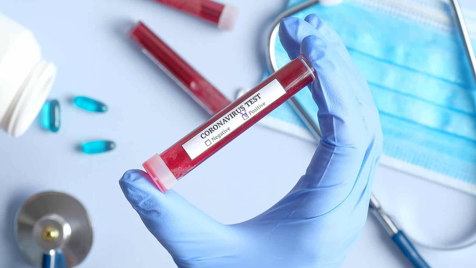 Lajm i mirë nga Kamenica: 34 banorë  dalin negativë në testimet për koronavirus