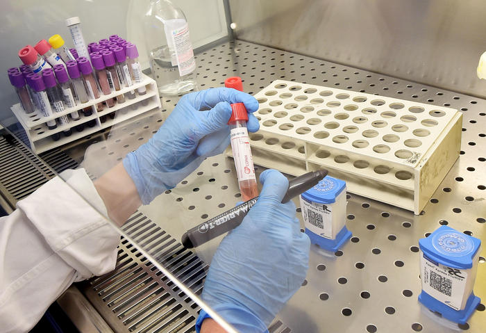 140 persona nga Topanica e Kamenicës në pritje për t’u testuar për koronavirus