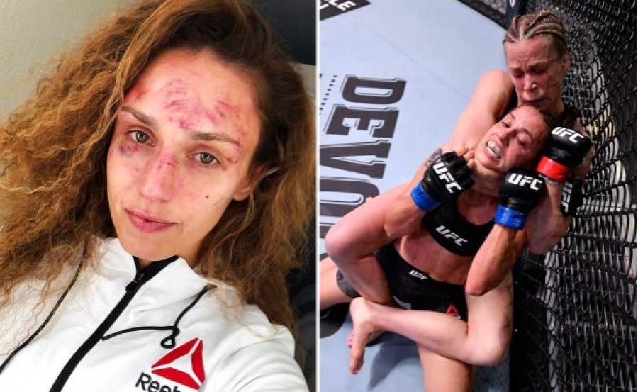 Rrahje brutale në meçin mes Katlyn Chookagianit dhe Shevchenko, kjo e fundit zbulon fytyrën e saj pas humbjes