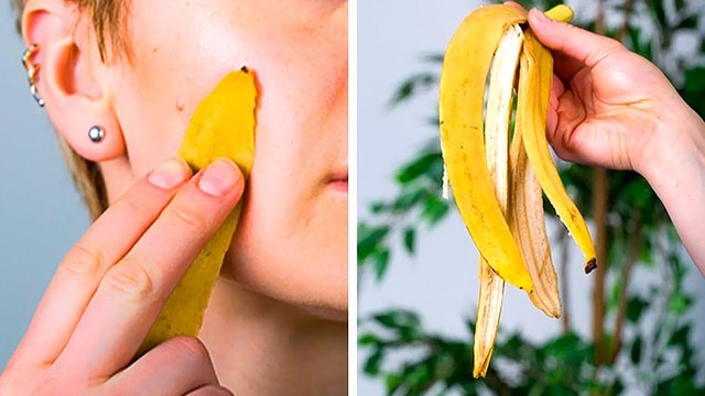 Pasi të mësoni 3 përdorimet fantastike të lëkurës së bananes, s’do i hidhni më në kosh