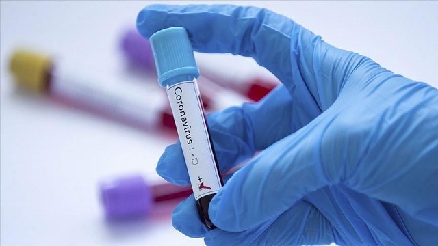 Dy mjekë infektohen me koronavirus në Lipjan