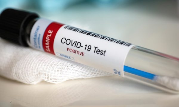 Mbi 18 milionë persona të prekur me koronavirus në botë