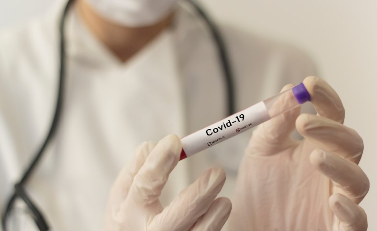 Askush nuk e di pse Kosovës s’po i njihen testet për koronavirus në vende të tjera