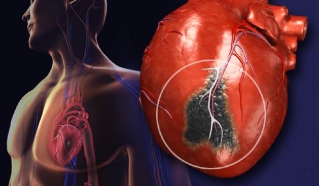 Pse po vdesin gjithnjë e më shumë pacientë me sëmundje zemre?