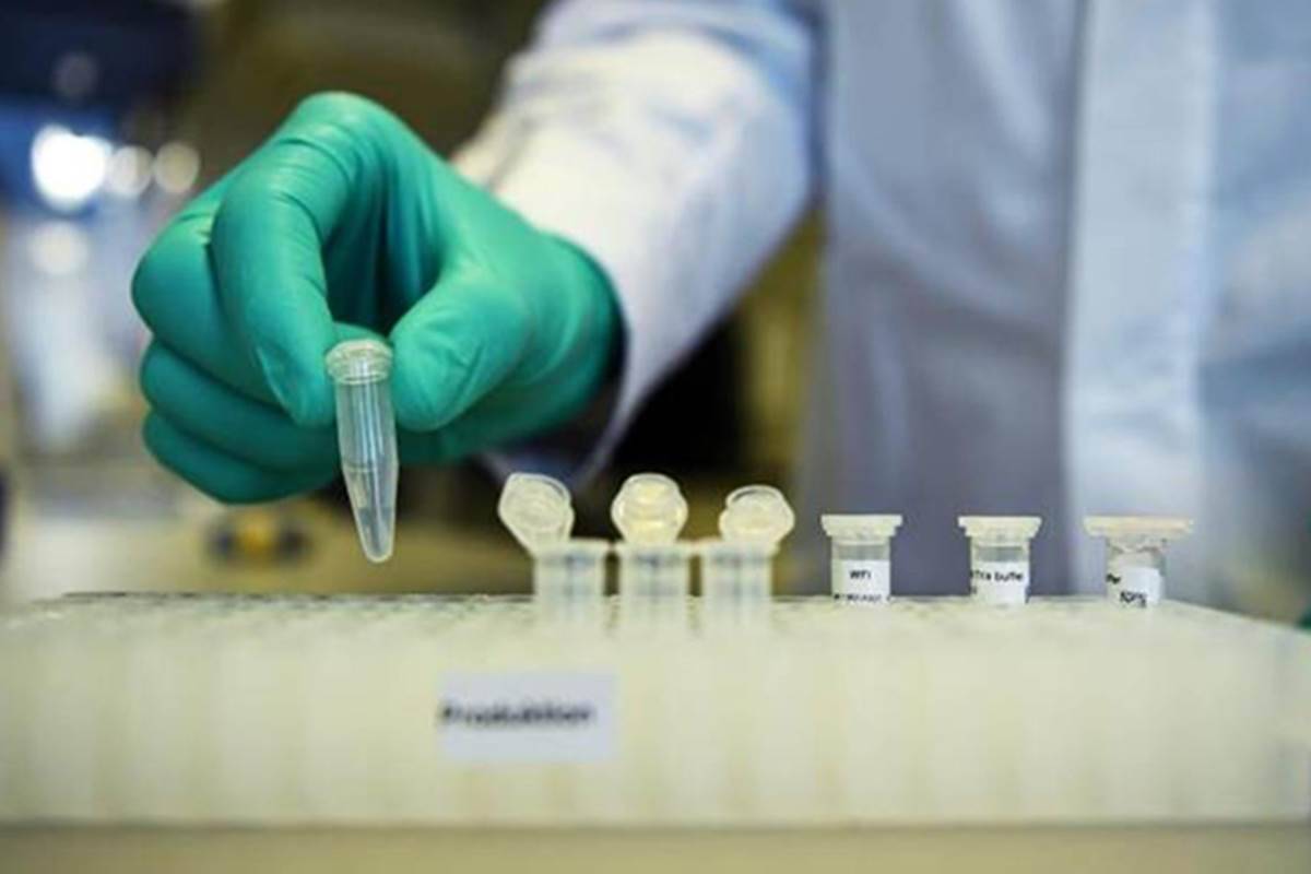 Licencohen edhe tetë laboratorë privatë për të kryer teste serologjike