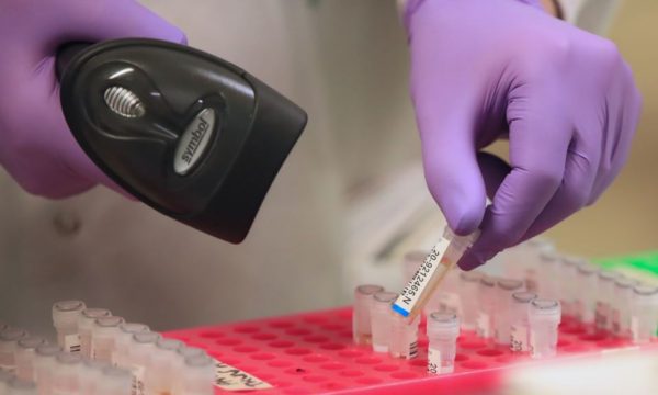 Këto grupe gjaku e vuajnë më shumë virusin COVID-19