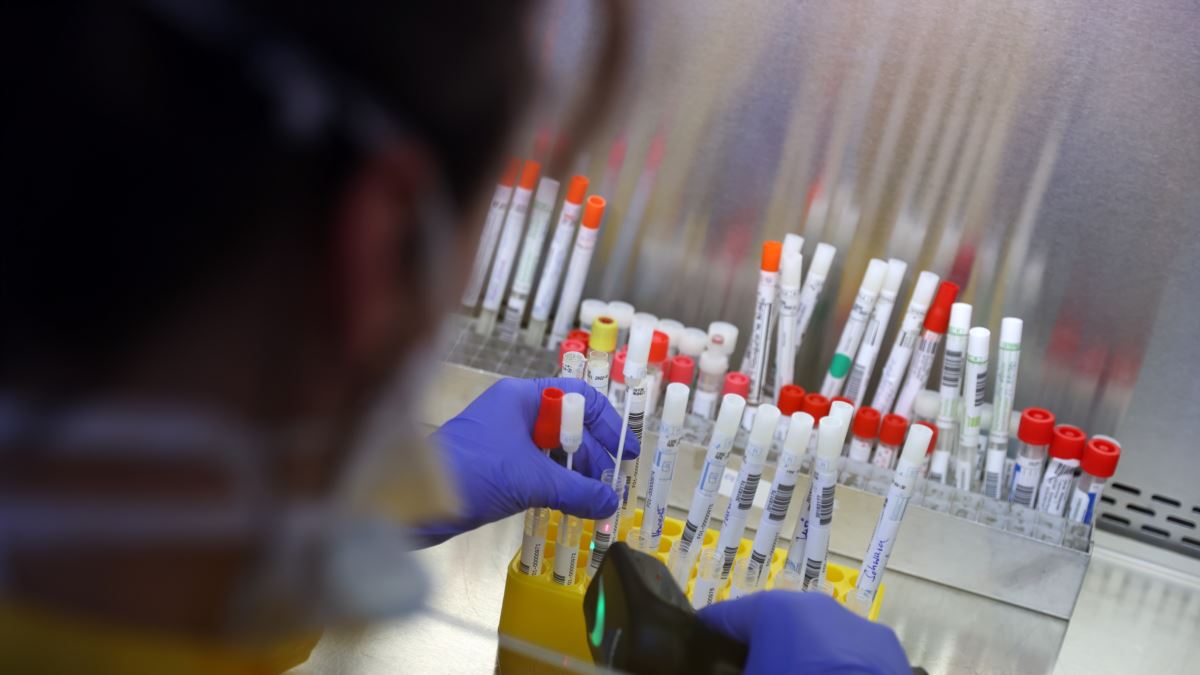 Deri në këtë ditë laboratorët privatë kanë kohë të caktojnë çmimet e testeve për koronavirus