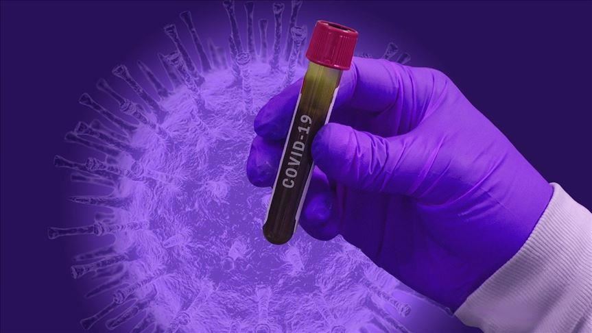 ​Mbi 700 mijë të vdekur deri më tani nga koronavirusi në botë