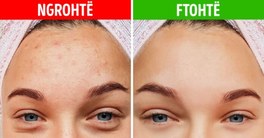 5 mrekulli që një dush i ftohtë bën për lëkurën tuaj