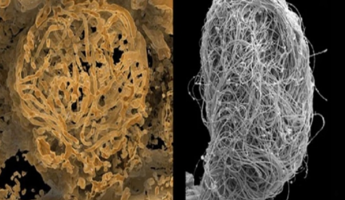 ​Mostra më e vjetër e spermës në botë zbulohet në një qelibar