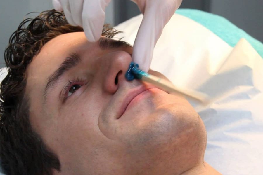 MJAFT i shkulët qimet e hundës, shaktojnë një sërë problemesh serioze për shëndetin