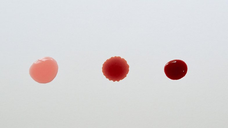 Nga infeksionet te kanceri: Gjakderdhja pas seksit – simptomat dhe shkaqet