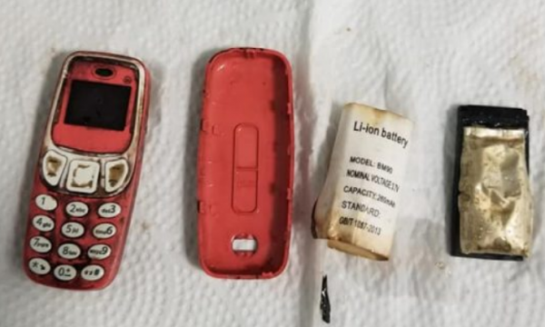 Flet doktori që ia nxori nga barku telefonin 33-vjeçarit: Bateria ishte me e rrezikshmja sepse mund të shpërthente