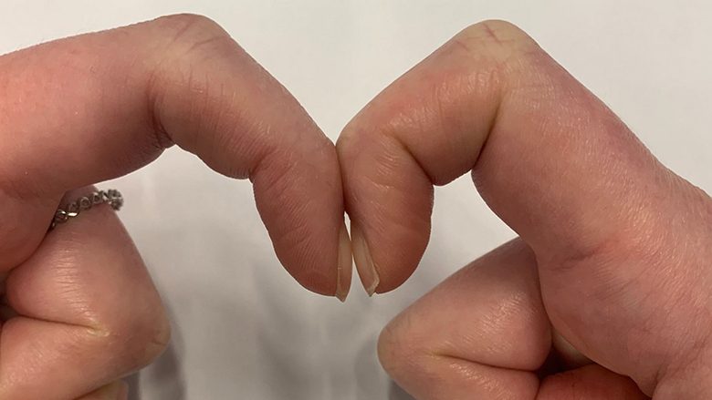 Testi në dy sekonda: Lidhni të dy gishtat tregues dhe zbuloni nëse jeni të kërcënuar nga një sëmundje të rrezikshme