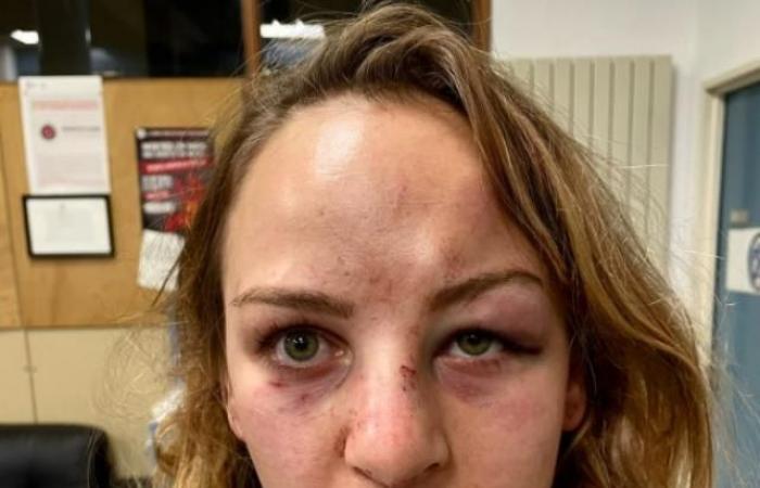 Xhudistja e rrahur brutalisht nga i dashuri dhe ish-trajneri: Më përlasi kokën përtokë i dehur, pashë vdekjen me sy