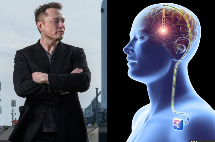 Së shpejti Elon Musk ofron çipa për trurin tuaj, a do ta pranonit vendosjen e tij?