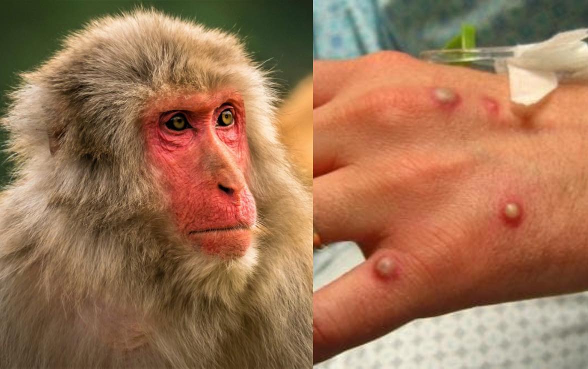 Konfirmohet rasti i parë i Lisë së majmunit në Greqi