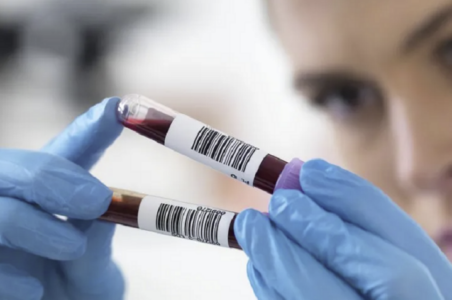 Analizat e gjakut tregojnë nëse organet plaken shpejt apo ngadalë