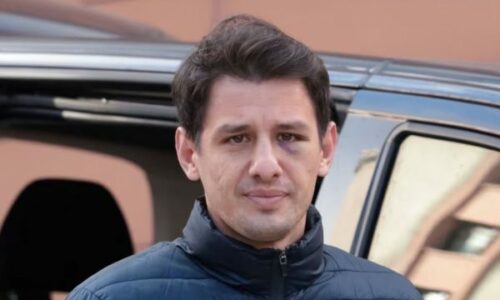 Referi turk që u sulmua fizikisht lirohet nga spitali