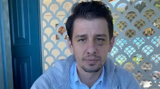 Pas lirimit nga spitali, gjyqtari turk zbulon për herë të parë se kush e nxiti presidentin e Ankaragucu ta godiste me grushte dhe shqelma