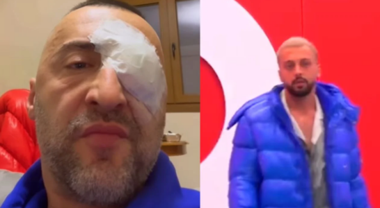 G-Bani shfaqet i përlotur, i del në krahë Gjestit: Nuk e meritoje, kam bërë gabim që…