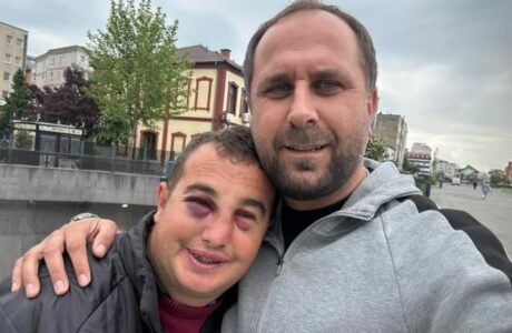 Sulmohet një person me aftësi të kufizuara në Ferizaj