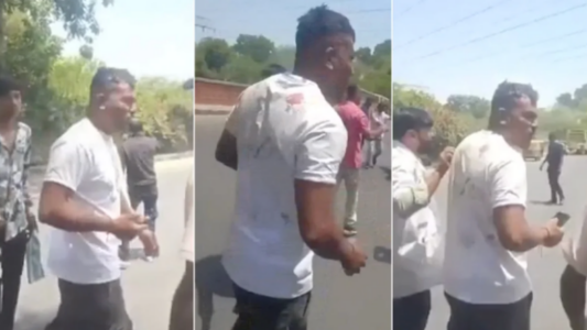 I mbijetuar i vetëm i tragjedisë ajrore në Indi – shihet me dëmtime të lehta në fytyrë dhe duke çaluar