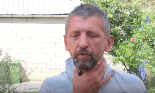 “Ma kanë ngjit për fyti”, flet burri që u sulmua nga policët në Klinë