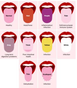 Çfarë tregon GJUHA jote për shëndetin, sipas shkencës