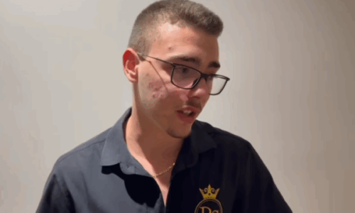 Kamarieri që u sulmua nga polici dhe një tjetër në Vlorë: Për një shishe uji më goditi me grushte, sapo i kam mbushur 18 vjet (Video)