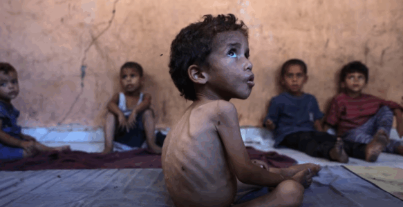 Amnesty akuzon Izraelin se qëllimshëm po shkakton uri në Gazë