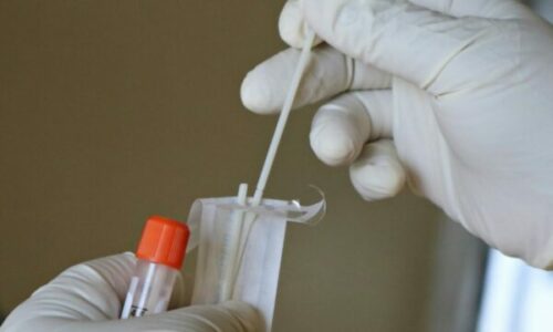 IKSHPK: Këtë vit u regjistruan 19 raste të reja me HIV/AIDS në Kosovë, një vdekje