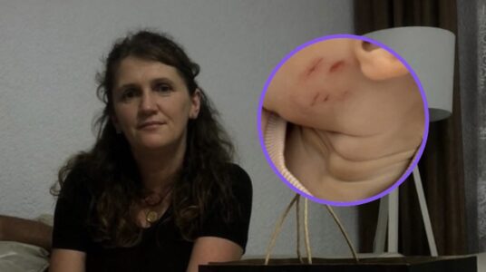 Suspendohet nga puna edukatorja e cila dyshohet se ushtroi dhunë ndaj një fëmije në Lipjan