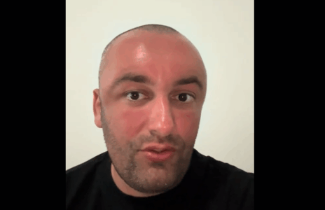 Samedi i “It’s My Home” denoncon publikisht, shfaqet i “stërkuqur” nga botoxi në Kosovë