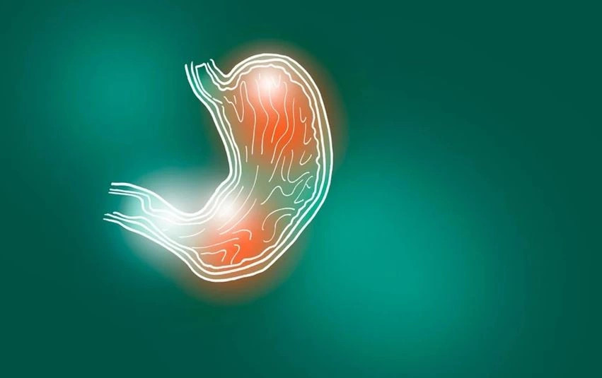 perimet-qe-largojne-fryrjen-e-stomakut