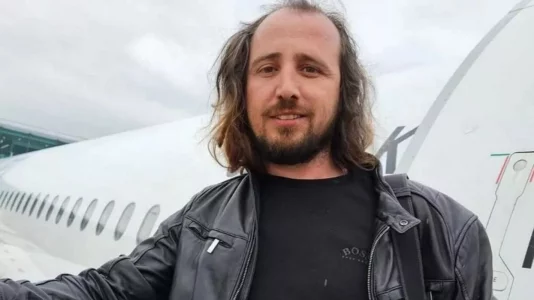 Shqiptari me shtetësi britanike vdes pas implantimit të dhëmbëve dhe të mbjelljes së flokëve në Turqi