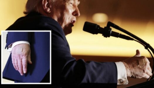 Presidenti Trump shfaqet me fasho në duar