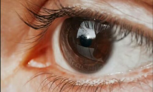 Simptoma pak e njohur e kancerit të syrit që shpesh ngatërrohet me diçka normale